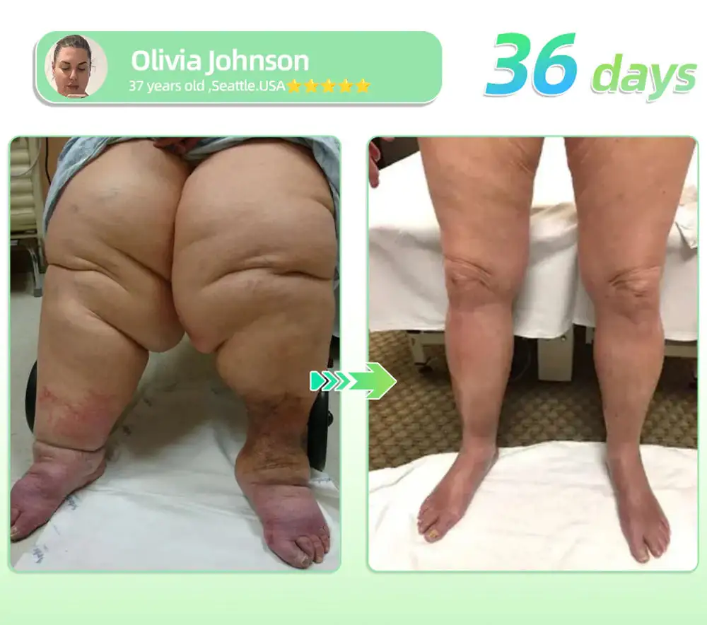 ๐ะะกะขะะยฎ๐ ๐ ะ โ๐ ๐บ๐ฐ๐ฟ ๐ฐ๐ต-๐ถ๐ต๐ฌ ๐ฏ๐๐๐๐๐ ๐บ๐๐๐๐๐๐๐ ๐ถ๐๐๐ ๐ณ๐๐๐๐๐